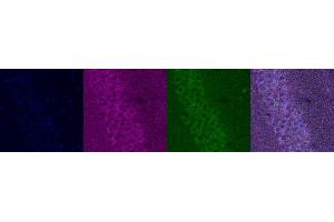 Immunohistochemistry (IHC) image for anti-Serotonin Receptor 1A (HTR1A) antibody (ABIN7456236)