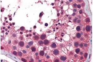 Human Testis: Formalin-Fixed, Paraffin-Embedded (FFPE)