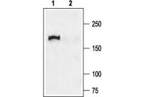 Western blot analysis of rat lung membranes: - 1. (CFTR anticorps  (C-Term, Cytosolic))