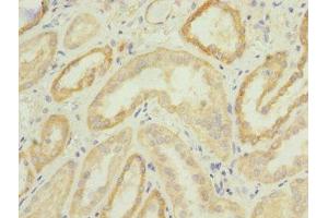 Immunohistochemistry of paraffin-embedded human kidney tissue using ABIN7147920 at dilution of 1:100 (CPSF4 anticorps  (AA 1-244))