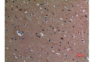 Immunohistochemistry (IHC) analysis of paraffin-embedded Human Brain, antibody was diluted at 1:100. (alpha Tubulin anticorps  (acLys40))