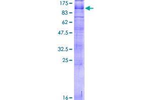 Image no. 1 for Polycystic Kidney Disease 2-Like 1 (PKD2L1) (AA 1-805) protein (GST tag) (ABIN1315206)