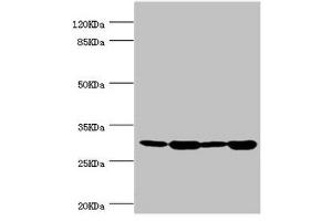 Western blot All lanes: BCAP29 antibody at 2. (BCAP29 anticorps  (AA 125-241))