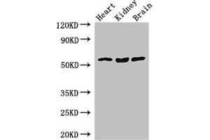 Western Blot Positive WB detected in: Mouse heart tissue, Mouse kidney tissue, Mouse brain tissue All lanes: SLC7A7 antibody at 3.