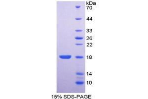 SDS-PAGE analysis of Human ENPP1 Protein. (ENPP1 Protéine)