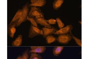 Immunofluorescence analysis of U-2 OS cells using RPL27 Polyclonal Antibody at dilution of 1:100 (40x lens).