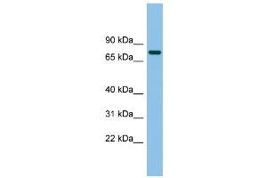 WB Suggested Anti-MTMR14 Antibody Titration: 0.