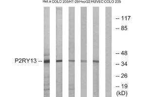 Western blot analysis of extracts from HeLa cells, COLO cells, HT-29 cells, HepG2 cells and HUVEC cells, using P2RY13 antibody. (Purinergic Receptor P2Y, G-Protein Coupled, 13 (P2RY13) (Internal Region) anticorps)