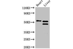 Western Blot Positive WB detected in: Mouse heart tissue, Mouse liver tissue All lanes: COQ6 antibody at 3 μg/mL Secondary Goat polyclonal to rabbit IgG at 1/50000 dilution predicted band size: 51, 49, 43 kDa observed band size: 51, 49 kDa (COQ6 anticorps  (AA 208-339))
