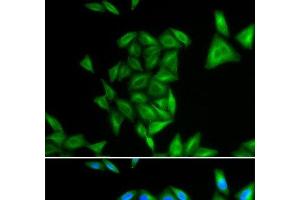 Immunofluorescence analysis of U2OS cells using PHYH Polyclonal Antibody (PHYH anticorps)