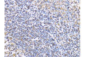 Immunohistochemistry of paraffin-embedded Human tonsil using Aconitase 2  antibody (ABIN1678537, ABIN3017991, ABIN3017992 and ABIN6220329) at dilution of 1:100 (40x lens).