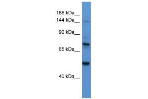 Astrotactin 2 antibody used at 1 ug/ml to detect target protein. (Astrotactin 2 anticorps  (N-Term))