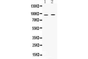 Western blot analysis of AKAP2 expression in rat cardiac muscle extract ( Lane 1) and HEPG2 whole cell lysates ( Lane 2).
