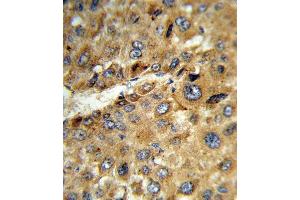 anti-Tat (AA 279-306) antibody