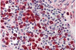Human Spleen (formalin-fixed, paraffin-embedded) stained with MMP9 antibody ABIN337212 at 5 ug/ml followed by biotinylated goat anti-rabbit IgG secondary antibody ABIN481713, alkaline phosphatase-streptavidin and chromogen. (MMP 9 anticorps)
