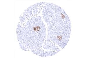 Positive NSE immunostaining of islets of Langerhans