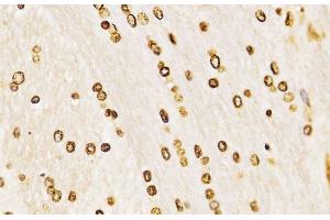 Immunohistochemistry of paraffin-embedded Rat brain using MonoMethyl-Histone H3-K27 Polyclonal Antibody at dilution of 1:200 (40x lens).