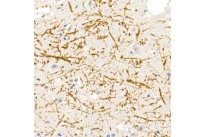 Immunohistochemistry of paraffin-embedded rat brain using Myelin Basic Protein Rabbit pAb (ABIN3022348, ABIN3022349, ABIN3022350 and ABIN6218754) at dilution of 1:100 (40x lens). (MBP anticorps  (AA 1-197))