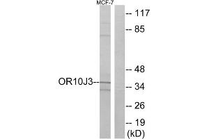 Western blot analysis of extracts from MCF-7 cells, using OR10J3 antibody. (OR10J3 anticorps  (C-Term))