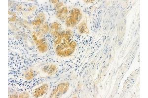 ABIN6258944 and ABIN6275125 at 1/100 staining human normal gastric tissue by IHC-P. (FKBPL anticorps  (Internal Region))
