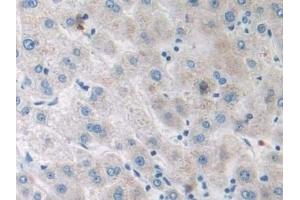 Detection of SIRT4 in Human Liver Tissue using Polyclonal Antibody to Sirtuin 4 (SIRT4)