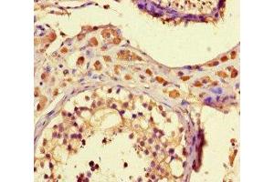 Immunohistochemistry of paraffin-embedded human testis tissue using ABIN7176295 at dilution of 1:100 (ZNF48 anticorps  (AA 317-635))