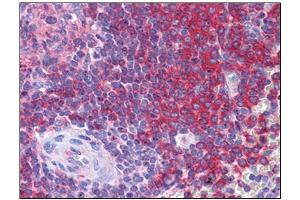 Human Spleen: Formalin-Fixed, Paraffin-Embedded (FFPE)