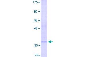 Image no. 1 for Low Density Lipoprotein Receptor-Related Protein 12 (LRP12) (AA 1-129) protein (GST tag) (ABIN2565190)