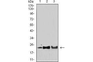Western blot analysis using SOD2 mouse mAb against Hela (1), HepG2 (2), and SH-SY5Y (3) cell lysate.