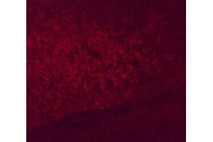 Anti-Six3 Antibody - Immunofluorescence Microscopy Immunofluorescence microscopy using  Anti-Six3 antibody shows detection of Six3 in PFA-fixed embryonic mouse prethalamus.