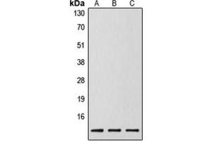 Western blot analysis of Caspase 14 p10 expression in MCF7 (A), mouse spleen (B), rat liver (C) whole cell lysates. (Caspase 14 p10 anticorps  (Center))