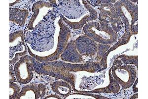 IHC analysis of SIRT5 using anti-SIRT5 antibody (ABIN7602524). (SIRT5 anticorps  (AA 81-310))