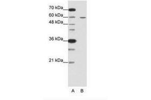 Image no. 2 for anti-Frizzled Family Receptor 5 (FZD5) (C-Term) antibody (ABIN6736225) (FZD5 anticorps  (C-Term))