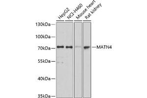 Western blot analysis of extracts of various cell lines, using M antibody (ABIN3016623, ABIN3016624, ABIN1680779 and ABIN6219802) at 1:3000 dilution. (MATN4 anticorps  (AA 221-540))