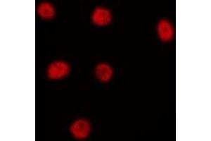 ABIN6274984 staining HepG2 by IF/ICC. (LYAR anticorps  (Internal Region))