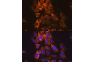 Immunofluorescence analysis of C6 cells using MEK1 antibody (ABIN7268633). (MEK1 anticorps)