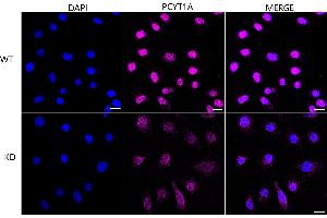 Immunocytochemical staining of HeLa cells using PCYT1A antibody (ABIN7799789), 1:1,000), Top panel: wild-type (WT), Bottom panal: PCYT1A shRNA knockdown (KD). (Recombinant PCYT1A anticorps)