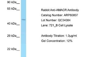 Western Blotting (WB) image for anti-alpha-Methylacyl-CoA Racemase (AMACR) (Middle Region) antibody (ABIN2788590) (AMACR anticorps  (Middle Region))