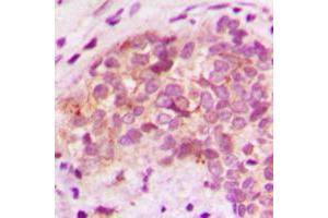 anti-Brain Protein 44-Like (BRP44L) (N-Term) antibody