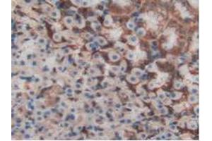 Detection of S100A11 in Rat Stomach Tissue using Polyclonal Antibody to S100 Calcium Binding Protein A11 (S100A11)