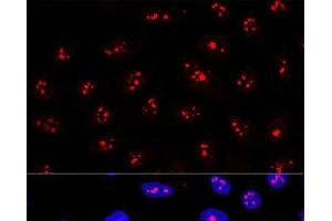Confocal immunofluorescence analysis of U2OS cells using MYBBP1A Polyclonal Antibody at dilution of 1:200. (MYBBP1A anticorps)