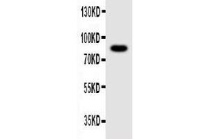 Anti-NLRP4G antibody, Western blotting WB: Mouse Ovary Tissue Lysate (NLRP4G anticorps  (C-Term))