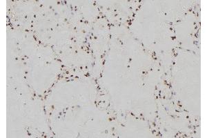 ABIN6269358 at 1/100 staining Human lung tissue by IHC-P. (IRF3 anticorps  (C-Term))