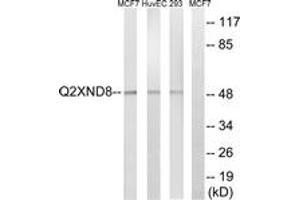 Western Blotting (WB) image for anti-Cytochrome P450, Family 2, Subfamily D, Polypeptide 6 (CYP2D6) (AA 41-90) antibody (ABIN2890723) (CYP2D6 anticorps  (AA 41-90))