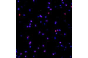 Immunofluorescent analysis of paraffin embedded rat brain using MED8 (ABIN7074582) at dilution of 1: 600 (MED8 anticorps)