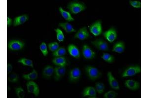 Immunofluorescence staining of A549 cells with ABIN7153831 at 1:66, counter-stained with DAPI. (GSG1-Like anticorps  (AA 84-176))