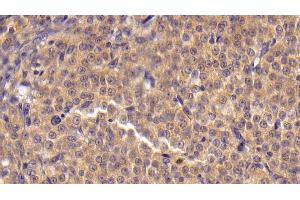 Detection of ANGPTL4 in Rat Ovary Tissue using Polyclonal Antibody to Angiopoietin Like Protein 4 (ANGPTL4)