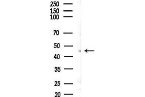 anti-Ceramide Synthase 2 (CERS2) (C-Term) antibody