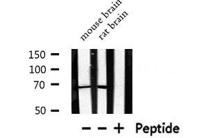Western blot analysis of RAD51 expression in various lysates