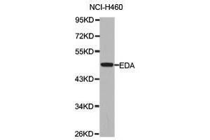 Western Blotting (WB) image for anti-Ectodysplasin A (EDA) antibody (ABIN1872415) (Ectodysplasin A anticorps)